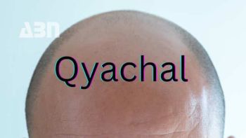 Հինգ դաս, որ Qyachal-ի վրիպակից կարող է սովորել ամեն բրենդ