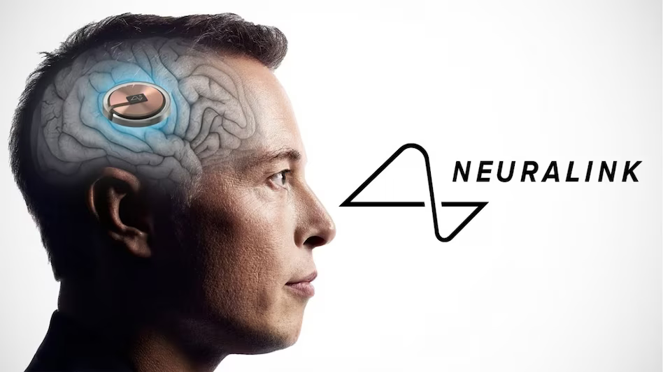 Իլոն Մասկի Neuralink-ը մարդկանց ուղեղում չիպեր տեղադրելու թույլտվություն է ստացել
