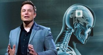 Ո՞վ առաջինը կստանա Neuralink-ի ուղեղի իմպլանտը