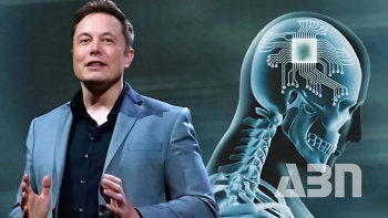 Neuralink-ի նեյրոչիպը առաջին անգամ հաջողությամբ տեղադրվել է մարդու գլխուղեղում